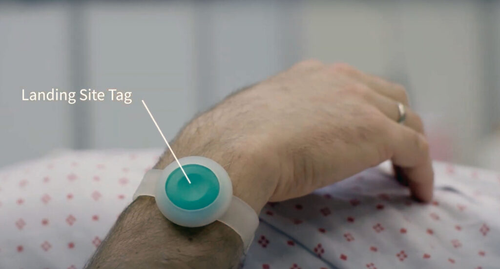 Quuppa landing site tag secured to patients wrist.